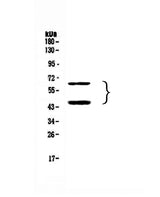 Anti-TIM 3/HAVCR2 Antibody Picoband® Boster Bio