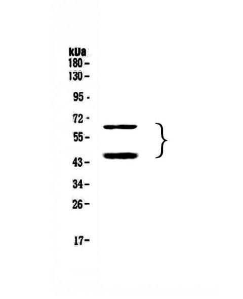 Anti-TIM 3/HAVCR2 Antibody Picoband® Boster Bio
