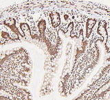 Anti-DDX5 Antibody Picoband® Boster Bio
