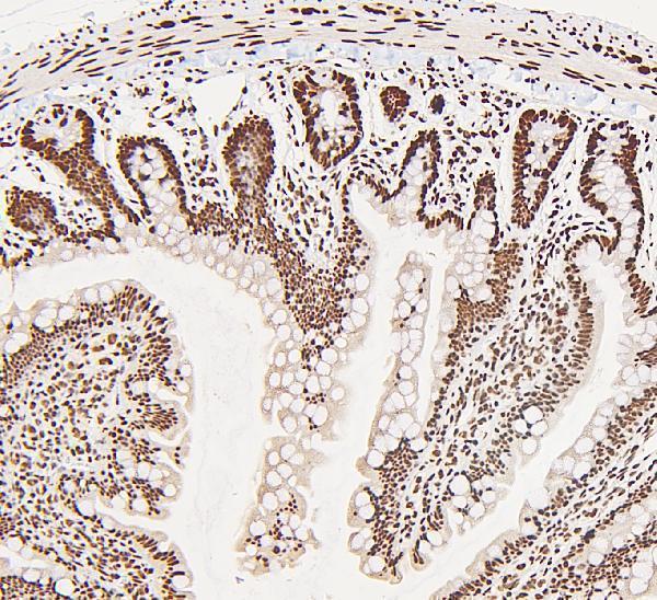 Anti-DDX5 Antibody Picoband® Boster Bio