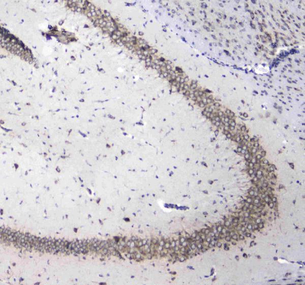 Anti-L1CAM Antibody Boster Bio