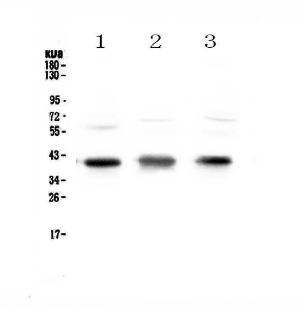 Anti-CCR4 Antibody Picoband® Boster Bio