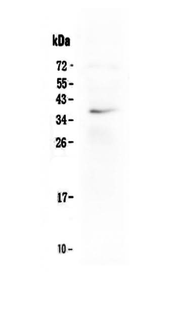 Anti-LOX-1/OLR1 Antibody Picoband® Boster Bio