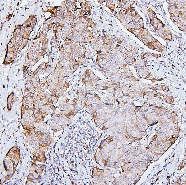 Anti-PKC delta/PRKCD Antibody Picoband® Boster Bio