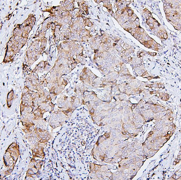 Anti-PKC delta/PRKCD Antibody Picoband® Boster Bio