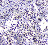 Anti-GFI1 Antibody Boster Bio
