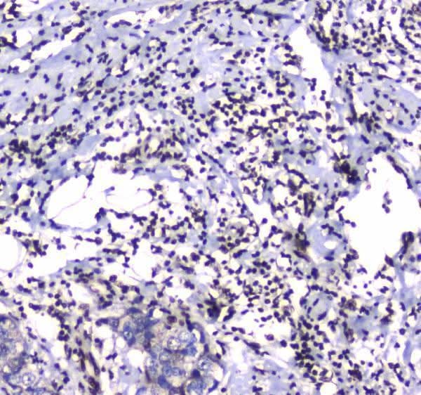 Anti-GFI1 Antibody Boster Bio