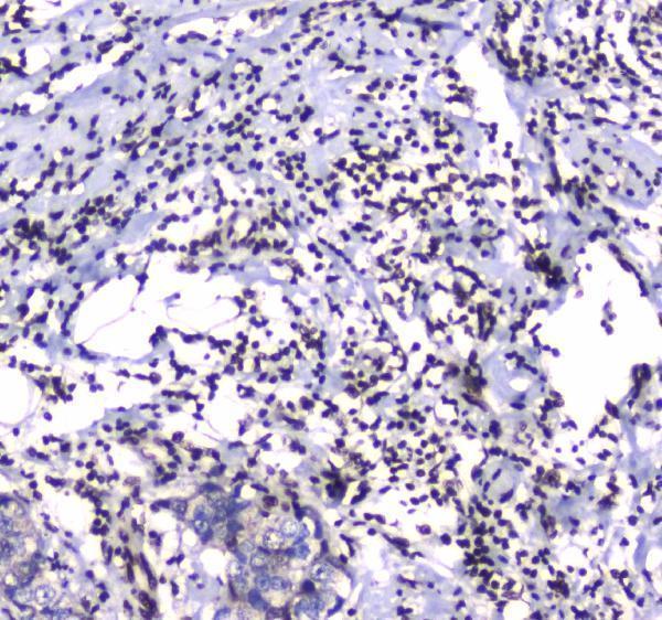 Anti-GFI1 Antibody Boster Bio