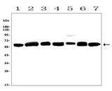 Anti-Calreticulin/CALR Antibody Picoband® Boster Bio