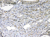 Anti-VEGF Receptor 2/KDR Antibody Picoband® Boster Bio