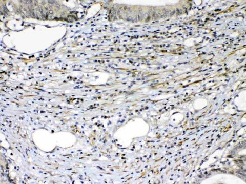 Anti-VEGF Receptor 2/KDR Antibody Picoband® Boster Bio