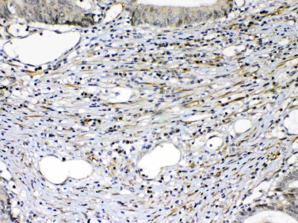Anti-VEGF Receptor 2/KDR Antibody Picoband® Boster Bio