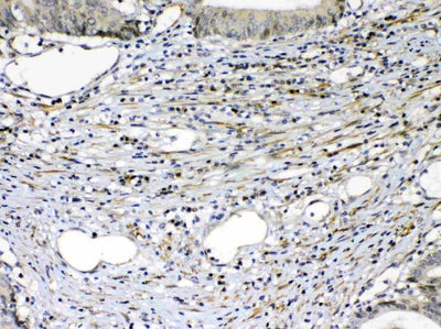 Anti-VEGF Receptor 2/KDR Antibody Picoband® Boster Bio