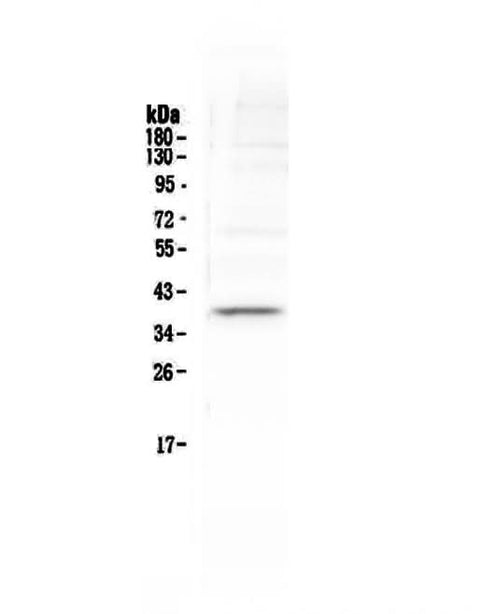 Anti-Tal1 Antibody Picoband® Boster Bio