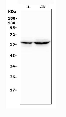 Anti-Cytochrome P450 2A6/CYP2A6 Antibody Picoband® Boster Bio