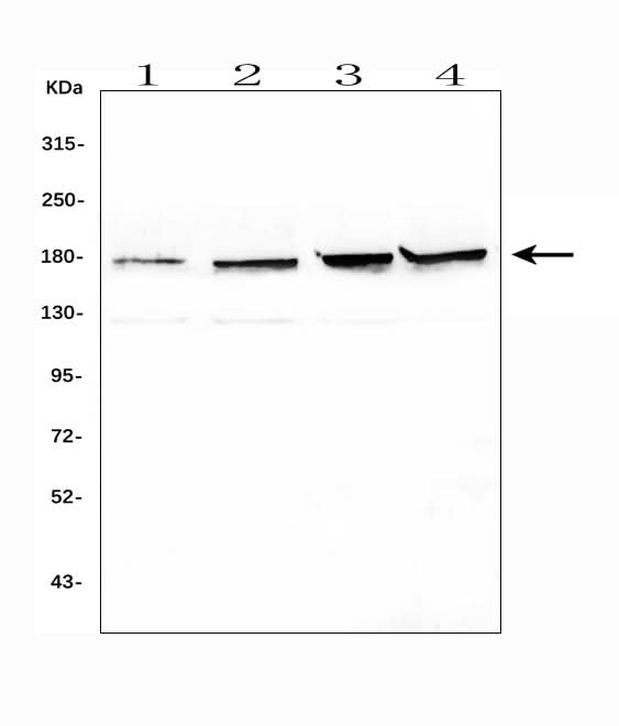 Anti-Topoisomerase II alpha/TOP2A Antibody Picoband® Boster Bio