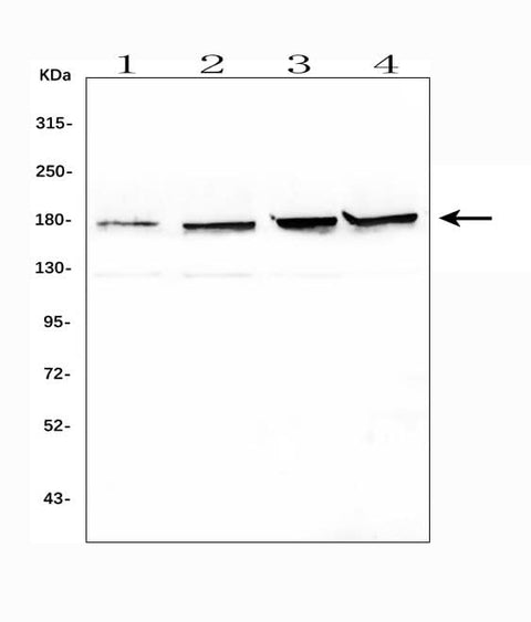 Anti-Topoisomerase II alpha/TOP2A Antibody Picoband® Boster Bio
