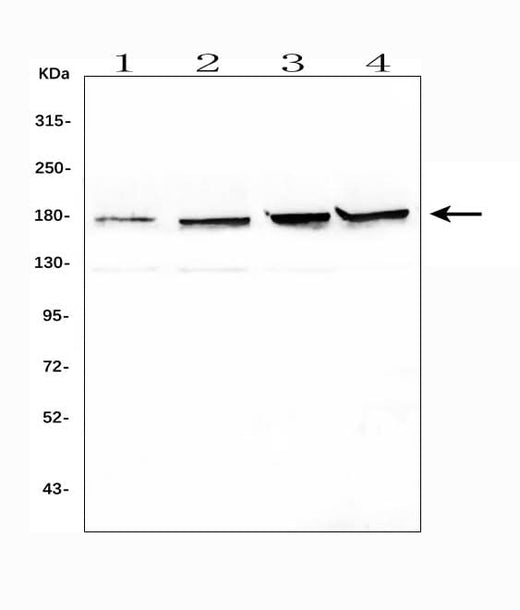 Anti-Topoisomerase II alpha/TOP2A Antibody Picoband® Boster Bio