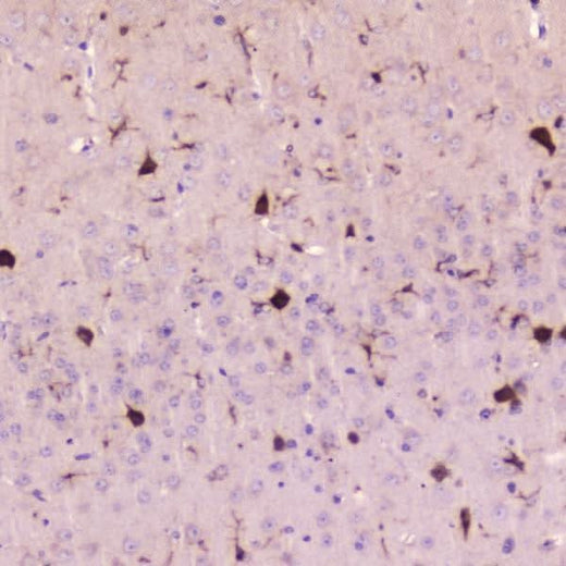 Anti-Cystatin C/CST3 Antibody Picoband® Boster Bio