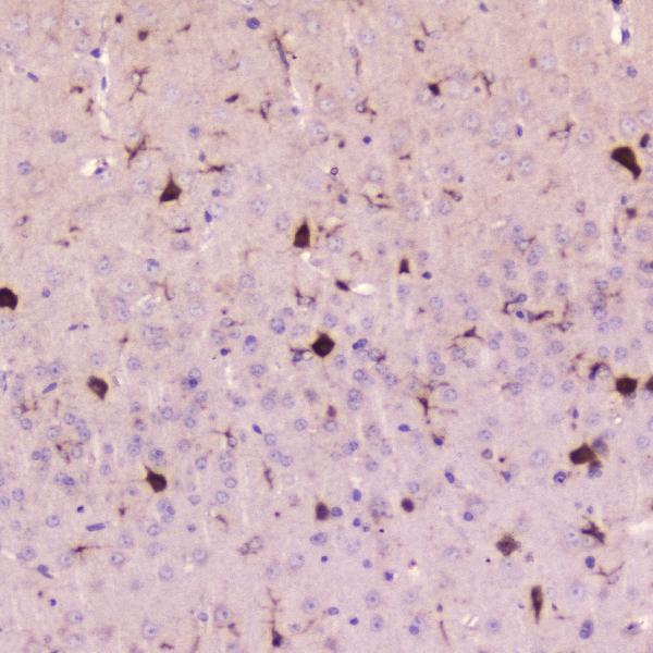 Anti-Cystatin C/CST3 Antibody Picoband® Boster Bio