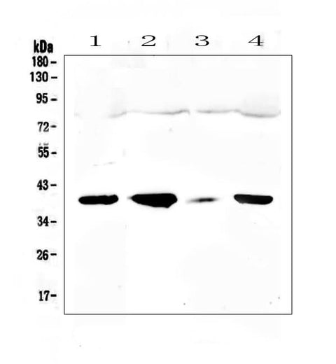 Anti-uPA Receptor/PLAUR Antibody Picoband® Boster Bio
