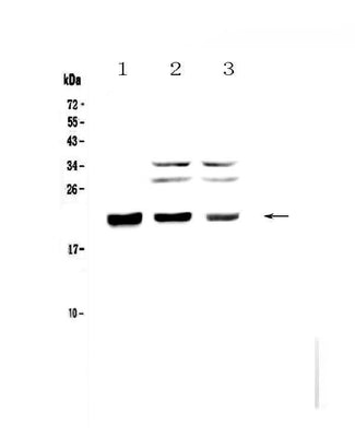 Anti-CBFb Antibody Picoband® Boster Bio
