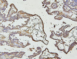 Anti-IRAK-1/IRAK1 Antibody Picoband® Boster Bio