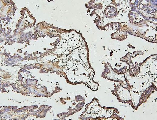Anti-IRAK-1/IRAK1 Antibody Picoband® Boster Bio