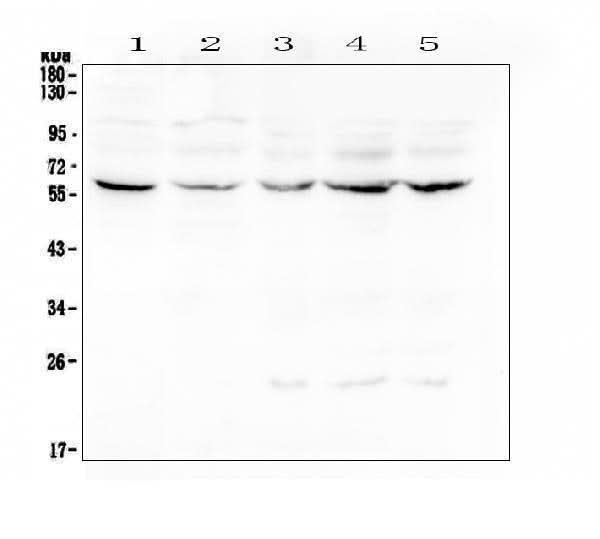 Anti-Lumican Antibody Picoband® Boster Bio