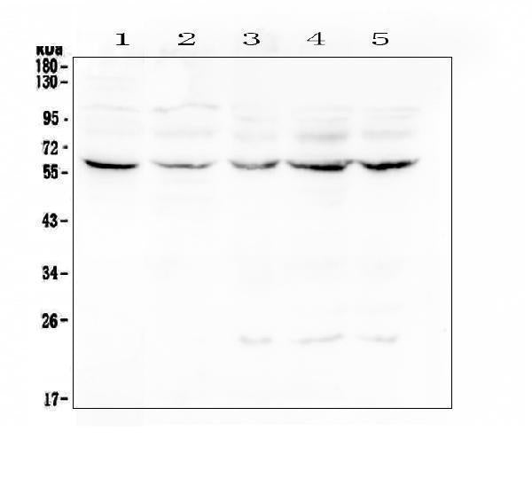 Anti-Lumican Antibody Picoband® Boster Bio
