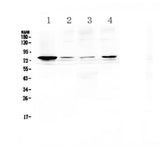 Anti-RANK/TNFRSF11A Antibody Picoband® Boster Bio