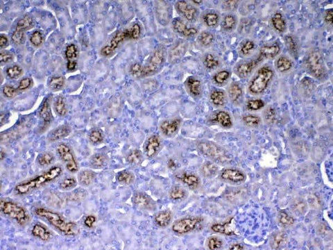 Anti-RBP4 Antibody Picoband® Boster Bio