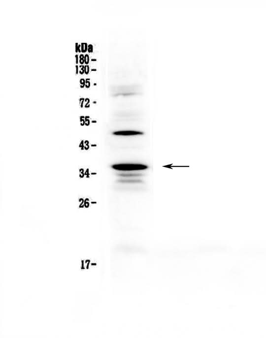 Anti-CD40L/Cd40lg Antibody Picoband® Boster Bio