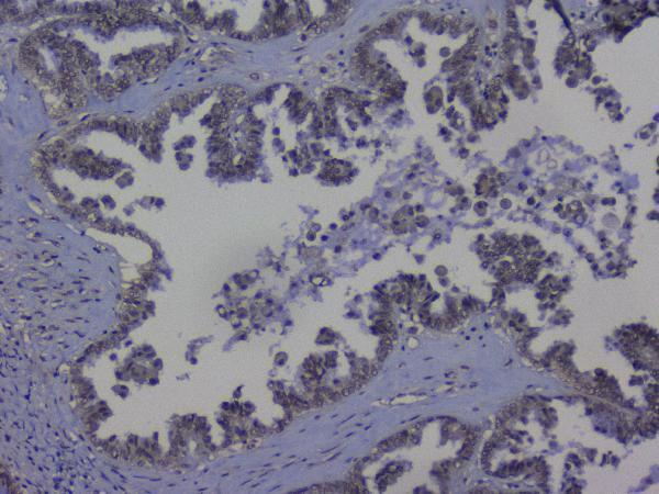 Anti-NRF1 Antibody Picoband® Boster Bio