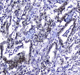 Anti-MDC1 Antibody Boster Bio