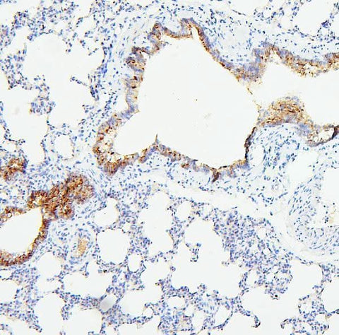 Anti-TIE2/TEK Antibody Picoband® Boster Bio