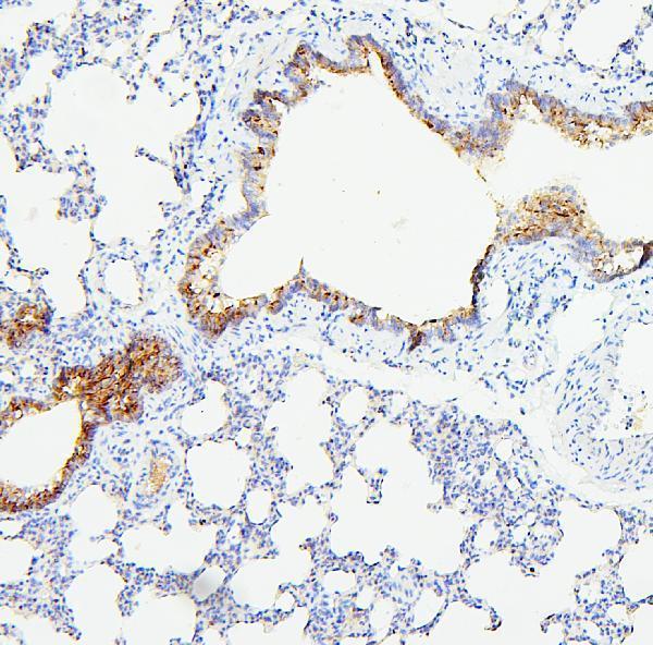 Anti-TIE2/TEK Antibody Picoband® Boster Bio