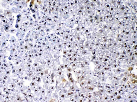 Anti-VEGF Receptor 3/FLT4 Antibody Picoband® Boster Bio