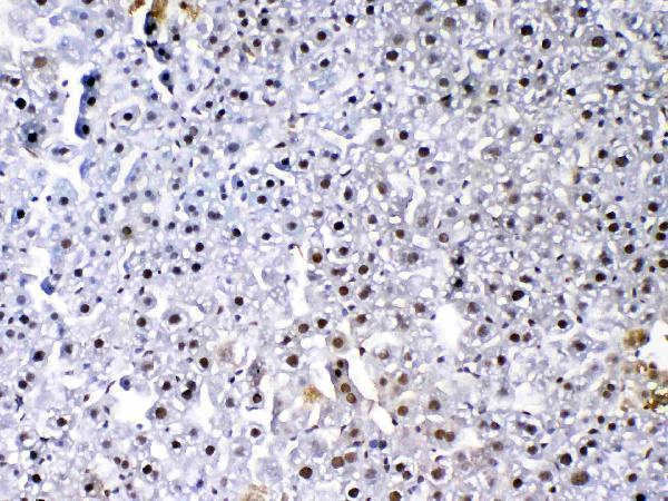 Anti-VEGF Receptor 3/FLT4 Antibody Picoband® Boster Bio