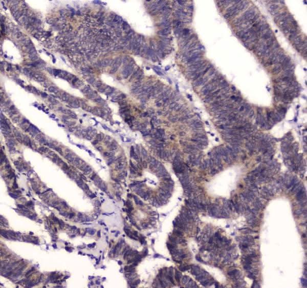 Anti-BRD7 Antibody Picoband® Boster Bio