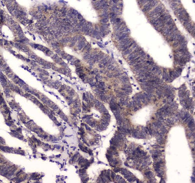 Anti-BRD7 Antibody Picoband® Boster Bio