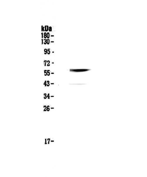 Anti-Cannabinoid Receptor I/CNR1 Antibody Picoband® Boster Bio