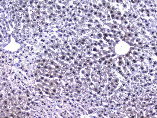 Anti-Retinoid X Receptor alpha/RXRA Antibody Picoband® Boster Bio