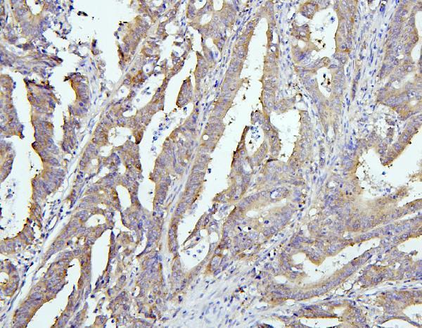 Anti-EIF4G1 Antibody Picoband® Boster Bio