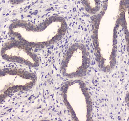 Anti-Insulin degrading enzyme/IDE Antibody Picoband® Boster Bio