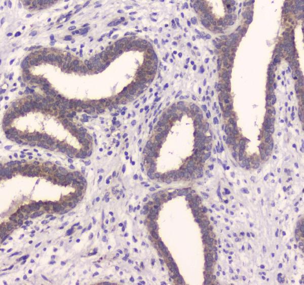 Anti-Insulin degrading enzyme/IDE Antibody Picoband® Boster Bio