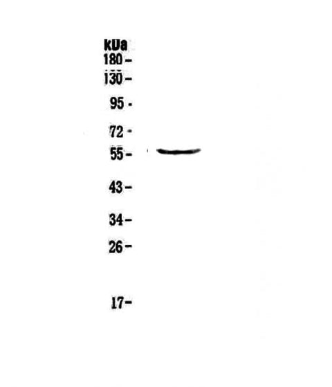 Anti-TRIM5 Antibody Picoband® Boster Bio