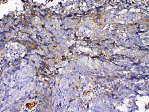 Anti-IGFBP2 Antibody Picoband® Boster Bio