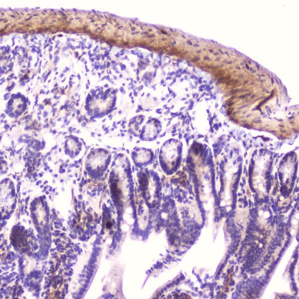 Anti-IGFBP2 Antibody Picoband® Boster Bio