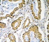 Anti-PRMT1 Antibody Picoband® Boster Bio